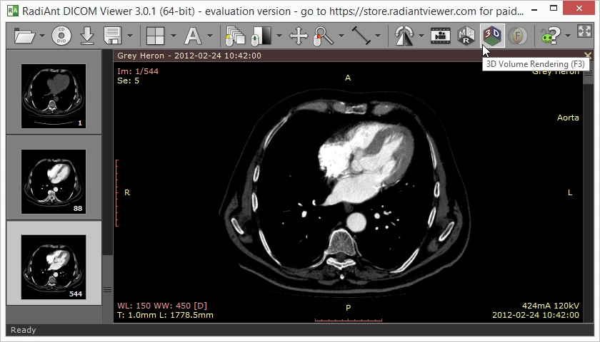 RadiAnt DICOM Viewer screenshot
