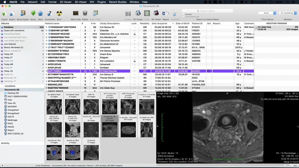 Osirix DICOM Viewer screenshot